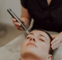 Formation nanoneedling 